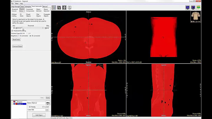 Analyze 14.0 - Segment: Region Grow