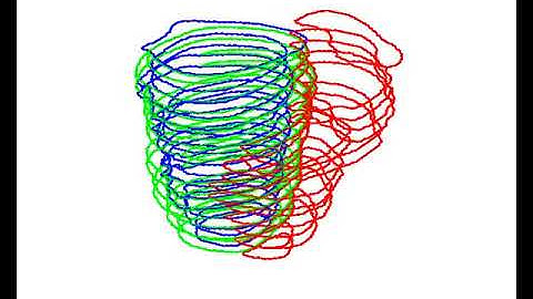 Automated cardiac MRI segmentation, 4D
