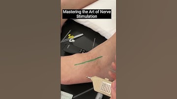 Mastering the Art of Nerve Stimulation Dr Poney Chiang