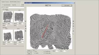 Dermatoglifia - Método Informatizado