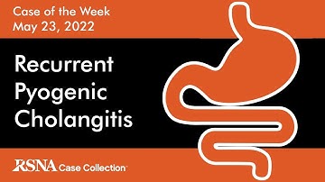 Case of the Week: Recurrent Pyogenic Cholangitis