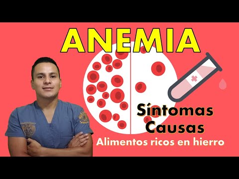 Vídeo: 3 maneres de saber si sou anèmic