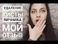 Лапароскопия яичника. Эндометриоидная киста. Часть 1