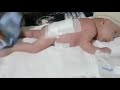 ما بعد العملية كيفاش نتعامل مع مرض ولدي وهنا كانت الصدمة الكبرى ما بعد العملية كيفاش نتعامل مع مرض ولدي وهنا كانت الصدمة الكبرى