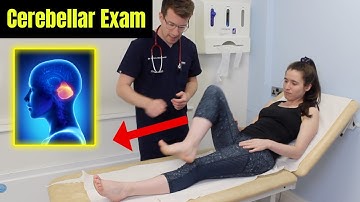 How to perform a CEREBELLAR EXAMINATION | OSCE and Clinical Skills guide by Doctor O