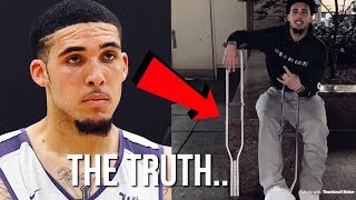 What They Don’t Want To Tell You About LiAngelo Ball Ankle Surgery...