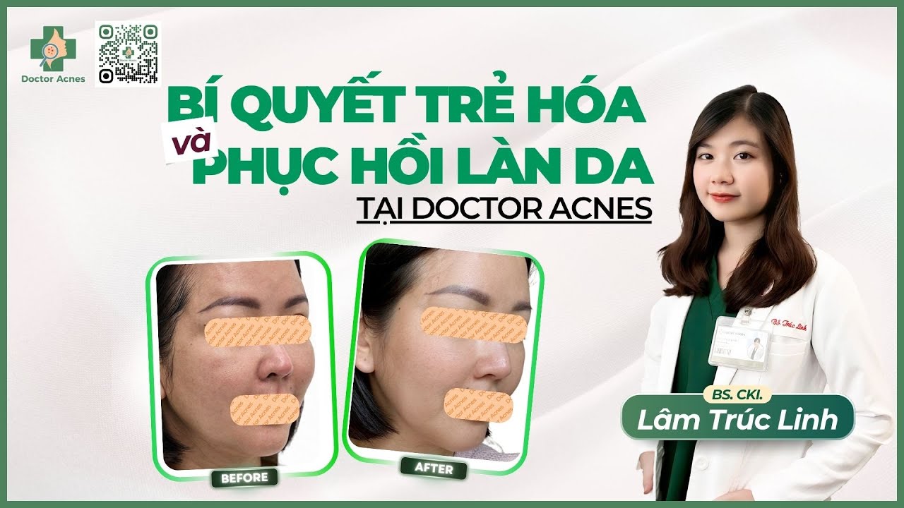 Mesotherapy for skin recovery