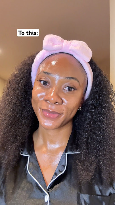 How to get rid of dark spots (hyperpigmentation hyperpigmentation #skincare #hyperpigmentation