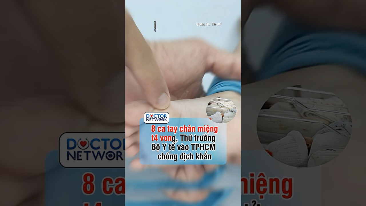 Dịch Tay chân miệng đang diễn biến phức tạp tại phía Nam với 17.000 ca mắc, 8 ca t4 vong.