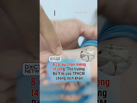 Dịch Tay chân miệng đang diễn biến phức tạp tại phía Nam với 17.000 ca mắc, 8 ca t4 vong.