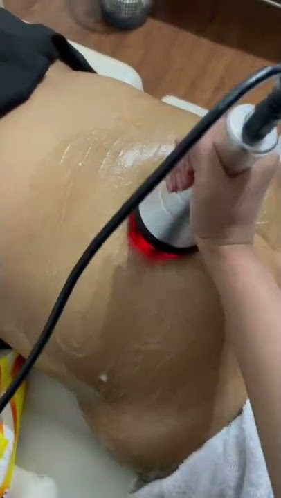 Mengecilkan perut dengan cara body rf, lemak langsung hancur seketika