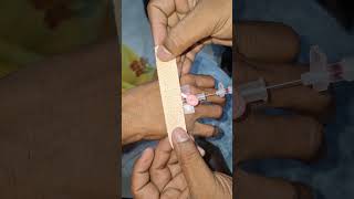 IV cannula technique video part 94#medicaldevice #hospital #love #hospital #video