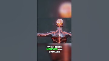 Peripheral Neuropathy: Know the Symptoms of Nerve Damage Now! #shorts