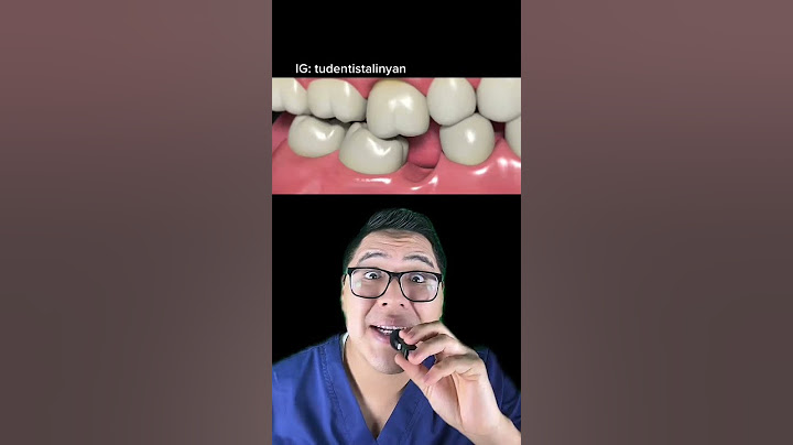 ¿Piensas sacarte una MUELITA? 😧😱👉🏻 MIRA ANTES ESTE VIDEO 👀