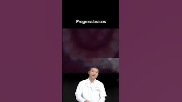 Kéo Răng Mọc Lệch Ngầm Khi Niềng Răng