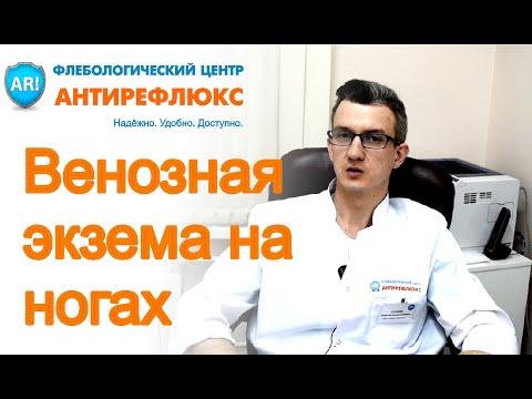 Варикозная (венозная) экзема на ногах: симптомы, причины, лечение