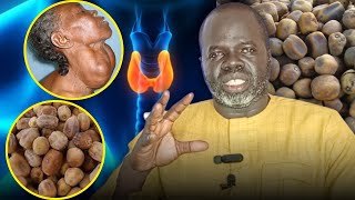 Ndiariniou SOUMPOU SI GOITRE - Pr Ousmane Ndiaye - SAMA XALAAT TV