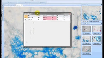 DeltaPix InSight   Bacteria detection avi