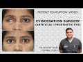 Evisceration  artificial eye surgery patient education by dr akshay nair mumbai