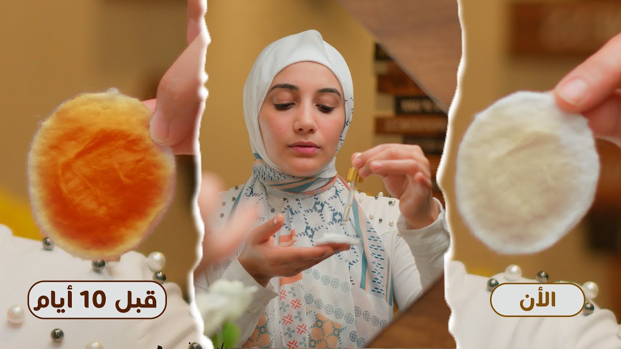 تجربتى كاملة مع تفتيح الأماكن الحساسة .. وأخيرا الحل لقيت المضمون |هنادى خطاب