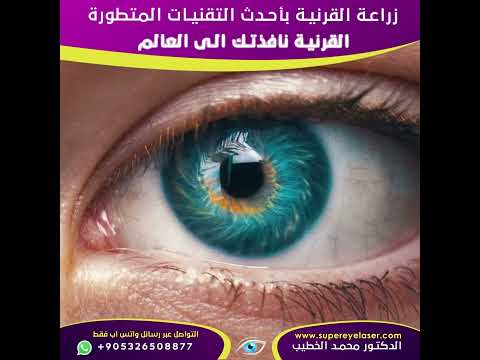 زراعة القرنية بأحدث التقنيات المتطورة