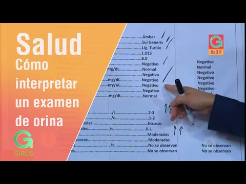 Cómo interpretar un examen de orina | Salud