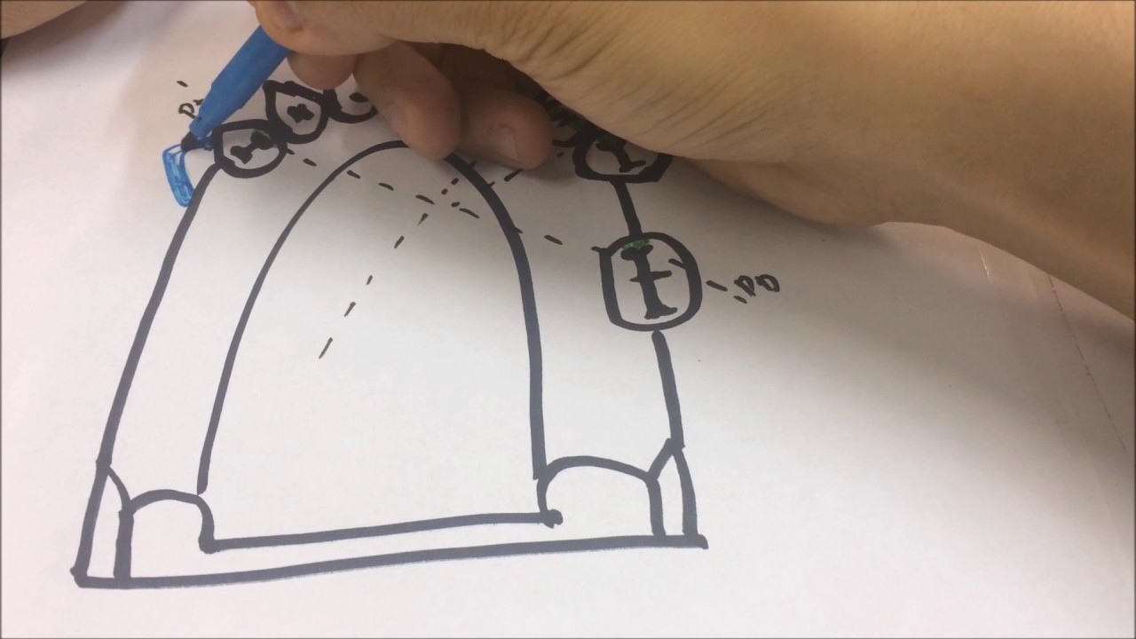 Planejamento em Prótese Parcial Removível (PPR)