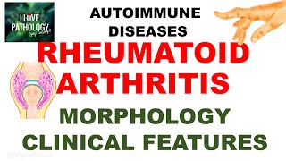 RHEUMATOID ARTHRITIS  |MORPHOLOGY, CLINICAL FEATURES & DIAGNOSIS by ilovepathology 50 views 2 hours ago 10 minutes, 12 seconds