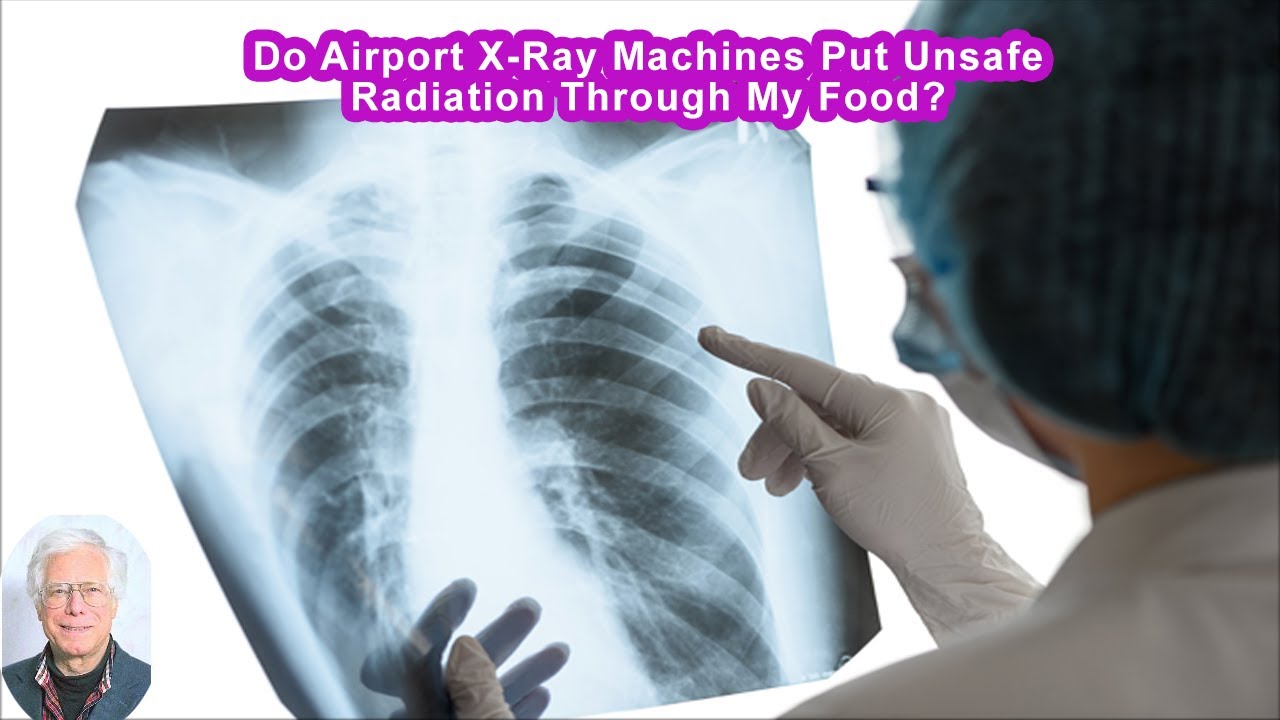 Do Airport XRay Machines Put Unsafe Radiation Through My Food? YouTube