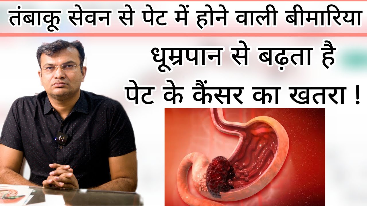 तंबाकू सेवन से पेट मे होने वाली बीमारिया तंबाकू खाने से पेट का कैंसर