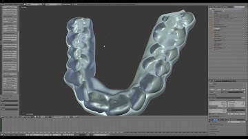 D3Splint - Introduction