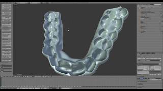 D3Splint - Introduction