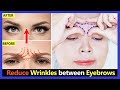 How to Get rid frown lines, Reduce Wrinkles between eyebrows Naturally | Face Yoga & Massage