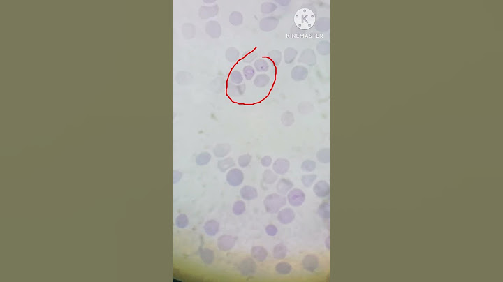 malaria parasite plasmodium vivax #malaria #plasmodium #vivax @mltwithmasood9010 #viralvideo