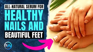 Foot Care: How To Get Beautiful Nails Naturally & Kill Nail Fungus Fast (Metanail Serum Pro Review)