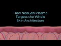 How neogen nitrogen plasma targets the whole skin architecture for skin resurfacing