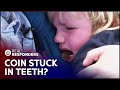 Doctors Remove Coin From Young Boys Teeth | Temple Street Children's Hospital | Real Responders