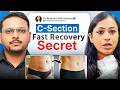 C-Section delivery ke baad kya khana chahiye, Belt kab lagani chahiye , Exercise kab shuru karein?