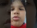 VEm.