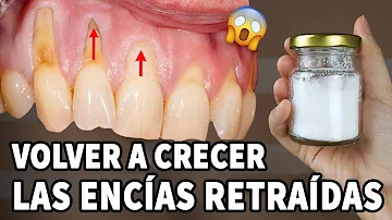 ¿Es buena la cúrcuma para las encías retraídas?