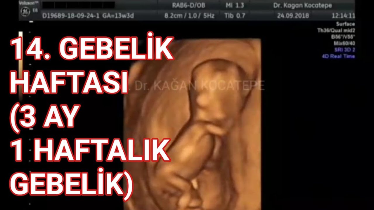 14 gebelik haftasi icinde 3 ay 1 haftada anne karninda bebege ait ultrason goruntuleri erkek youtube
