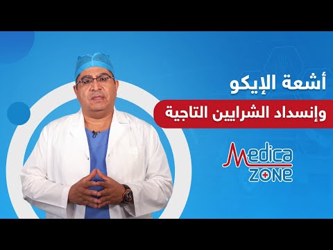 هل اشعة الايكو كافية لتشخيص انسداد الشرايين التاجية دكتور اسامة عباس