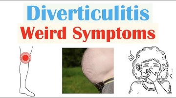 Weird Symptoms of Diverticulitis | Atypical Clinical Features of Diverticulitis