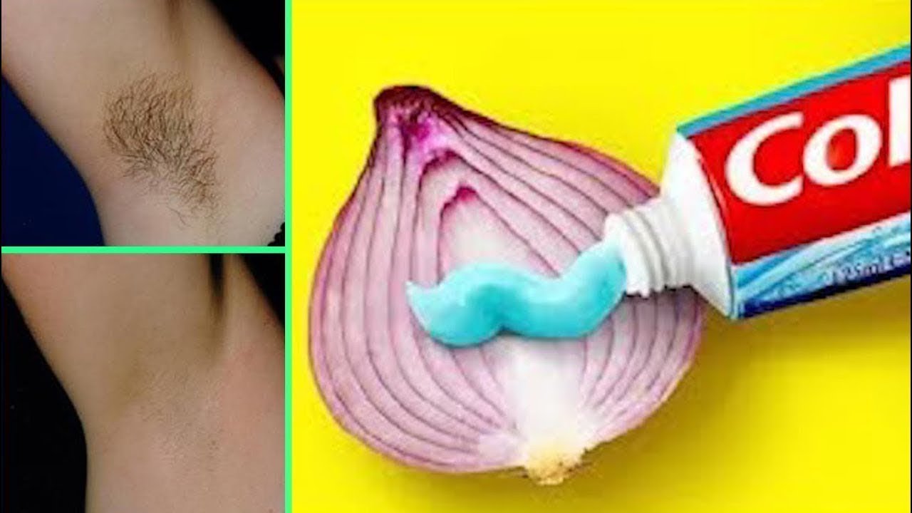नीचे के बालों को 5 मिनट में हमेशा के लिए ख़त्म करे | Remove Your All ...