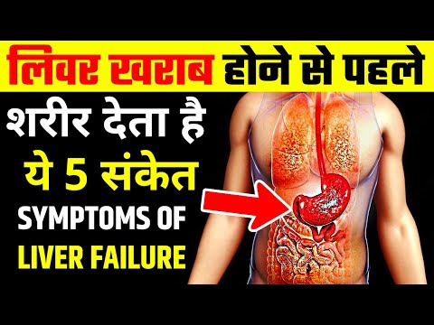 लिवर खराब होने से पहले देता है ये 5 संकेत अगर समय पर नहीं पता चला तो मौत पक्की liver damage symptoms