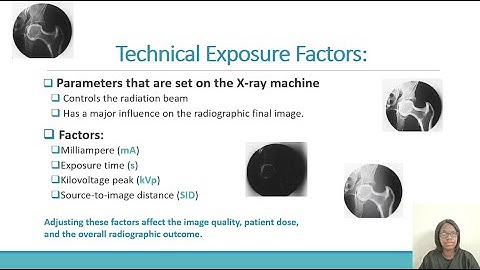 Radiology Students MUST Know This: kVp & mAs Explained!