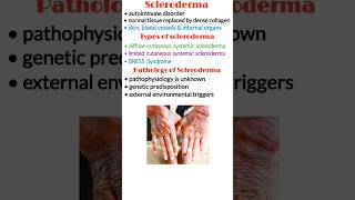 Scleroderma (systemic sclerosis), scleroderma types, scleroderma treatment, medical shorts shorts