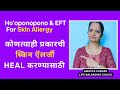 The Ultimate Guide to Skin Allergy Healing| Ho'oponopono & EFT|स्किन ऍलर्जी Heal करण्यासाठी|#loa