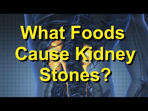 what-foods-cause-kidney-stones?