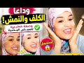 وصفة خطييرة للتخلص من الكلف والنمش في وقت قصير